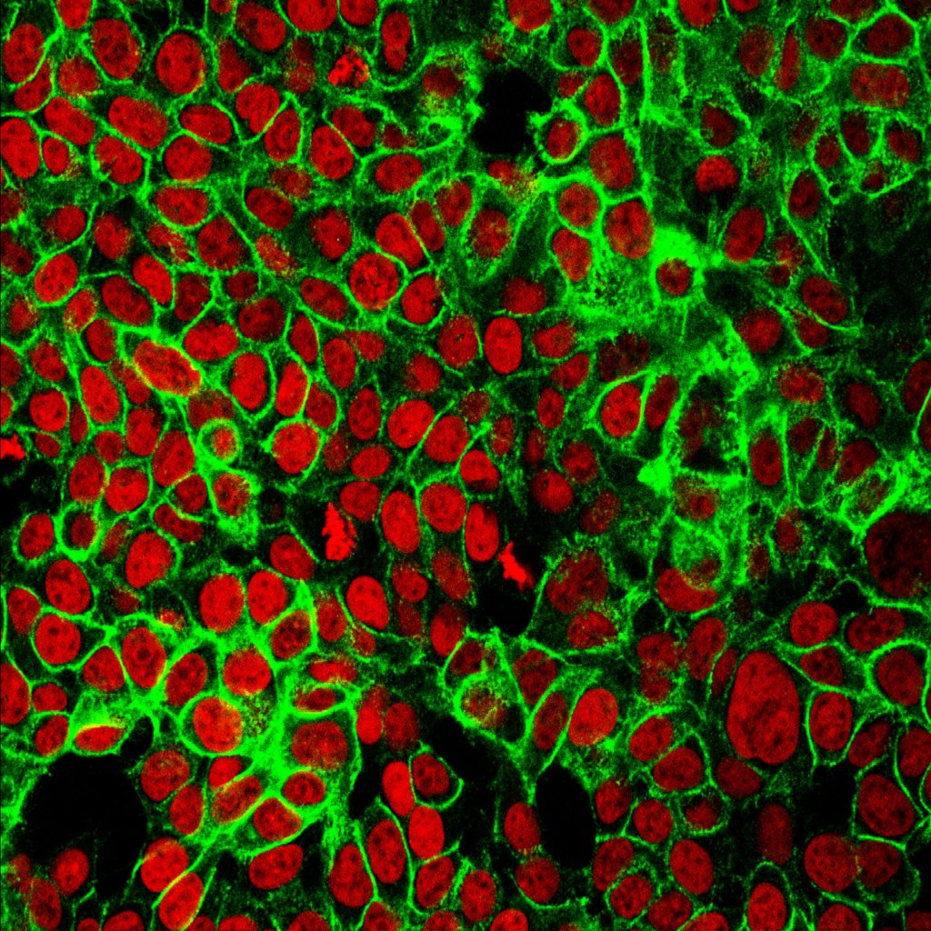 physical level structure of cancer cells for frequency healing through frequency repatterning